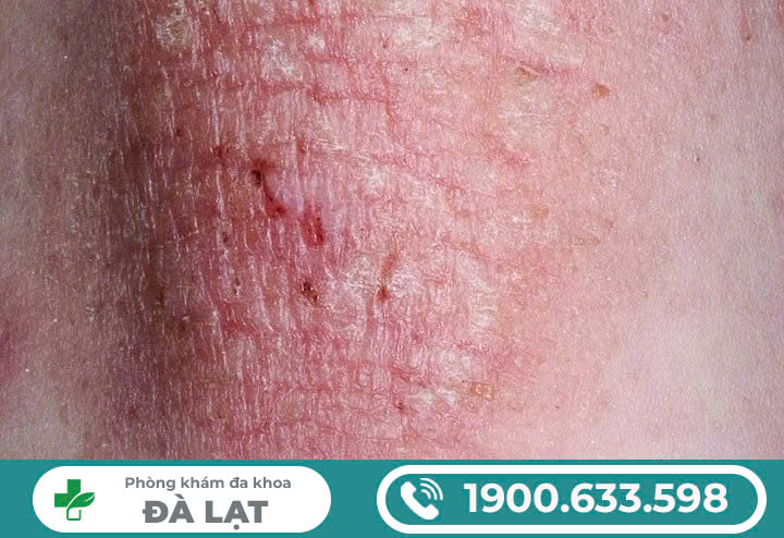 Hình ảnh minh họa